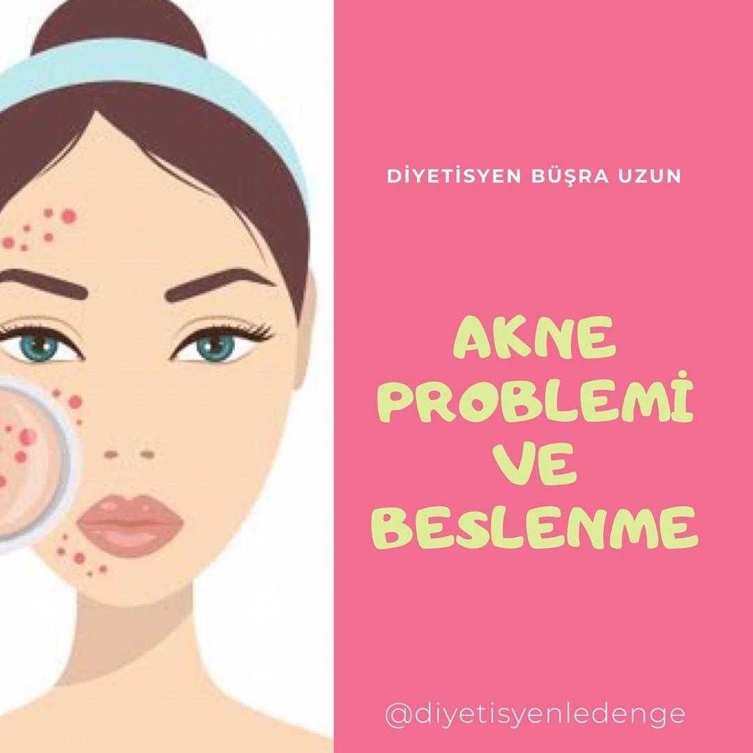 AKNE PROBLEMİ VE BESLENME 