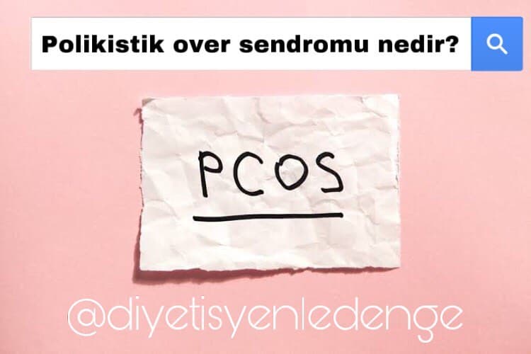 PCOS NEDİR 