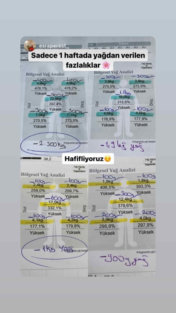 Uzman Diyetisyen Büşra Yılmaz - 24. Fotoğraf Uzman Diyetisyen Büşra Yılmaz - 24. Fotoğraf