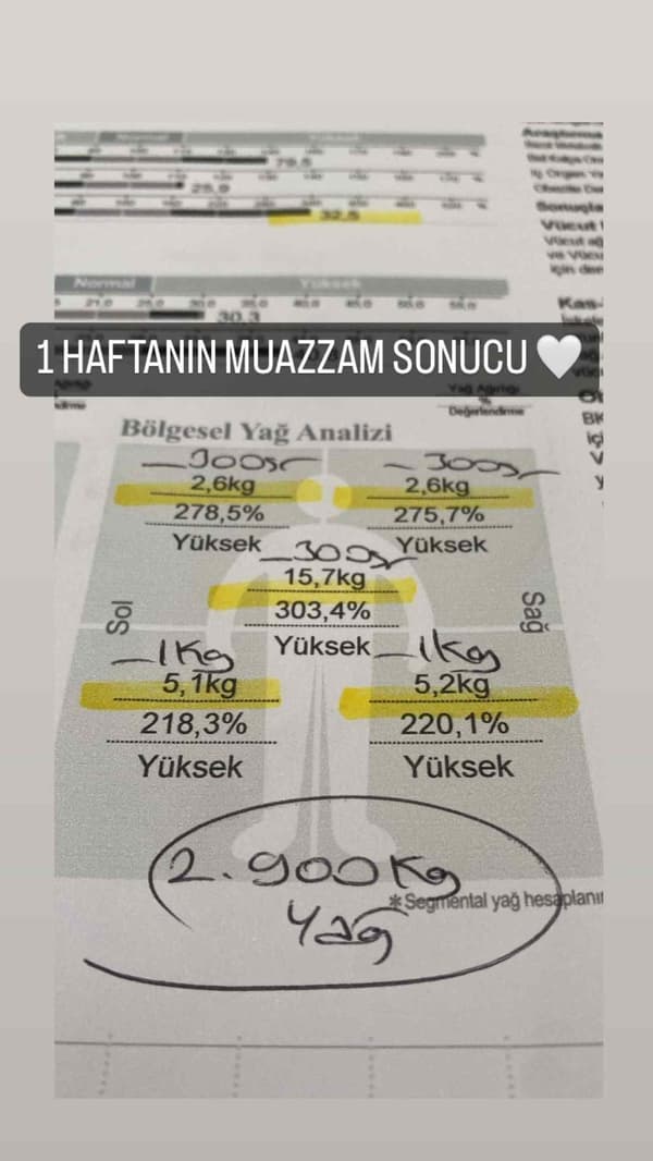 Uzman Diyetisyen Büşra Yılmaz - 29. Fotoğraf