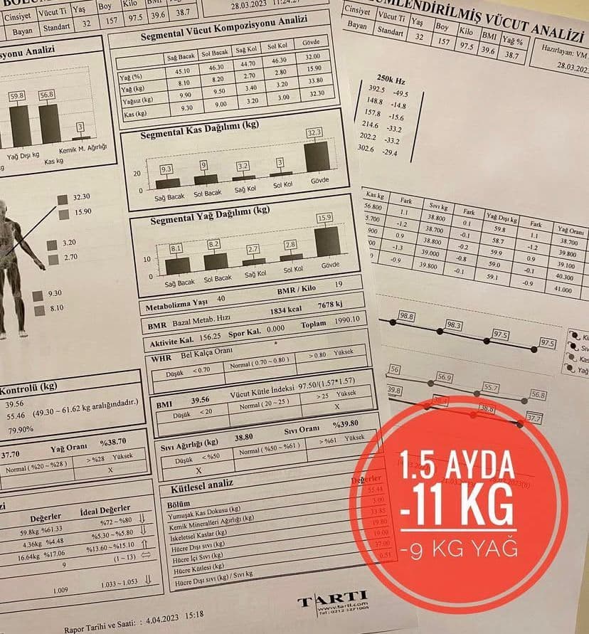 Uzman Dyt. Cansu Özçelik - Öveçler Karbonhidrat Sayımı Konusunda Bilgilendirme - 2. Fotoğraf